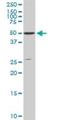 Serine/Threonine Kinase 4 antibody, H00006789-M02, Novus Biologicals, Western Blot image 