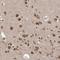 Zinc Finger Protein 710 antibody, NBP1-84166, Novus Biologicals, Immunohistochemistry frozen image 