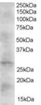 Dickkopf WNT Signaling Pathway Inhibitor 2 antibody, 45-484, ProSci, Western Blot image 