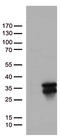 O-6-Methylguanine-DNA Methyltransferase antibody, LS-C799236, Lifespan Biosciences, Western Blot image 