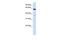 ALG6 Alpha-1,3-Glucosyltransferase antibody, GTX46385, GeneTex, Western Blot image 