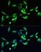 SMAD Family Member 3 antibody, LS-C746959, Lifespan Biosciences, Immunofluorescence image 