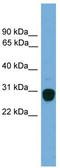 Triggering Receptor Expressed On Myeloid Cells 2 antibody, TA331072, Origene, Western Blot image 