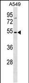 Transmembrane 6 Superfamily Member 1 antibody, PA5-48742, Invitrogen Antibodies, Western Blot image 