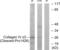 Collagen Type IV Alpha 3 Chain antibody, abx015580, Abbexa, Western Blot image 