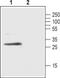 Free Fatty Acid Receptor 1 antibody, PA5-77398, Invitrogen Antibodies, Western Blot image 