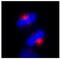 Centrosomal Protein 170 antibody, NB100-55317, Novus Biologicals, Immunocytochemistry image 