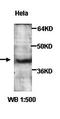 ATF4 antibody, orb77131, Biorbyt, Western Blot image 