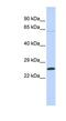 ATP Synthase Peripheral Stalk-Membrane Subunit B antibody, NBP1-54702, Novus Biologicals, Western Blot image 