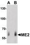 Malic Enzyme 2 antibody, PA5-38007, Invitrogen Antibodies, Western Blot image 
