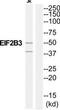 Eukaryotic Translation Initiation Factor 2B Subunit Gamma antibody, TA312679, Origene, Western Blot image 