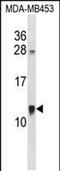 Acyl-CoA Binding Domain Containing 7 antibody, PA5-48710, Invitrogen Antibodies, Western Blot image 