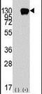 Receptor Tyrosine Kinase Like Orphan Receptor 1 antibody, PA5-14726, Invitrogen Antibodies, Western Blot image 