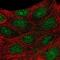 Protein Arginine Methyltransferase 6 antibody, NBP2-32459, Novus Biologicals, Immunofluorescence image 