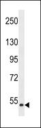 Plaucible mixed-lineage kinase antibody, 63-376, ProSci, Western Blot image 