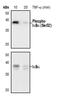 NFKB Inhibitor Alpha antibody, MA5-15191, Invitrogen Antibodies, Western Blot image 