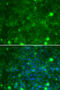 TIMP Metallopeptidase Inhibitor 3 antibody, 15-883, ProSci, Immunofluorescence image 