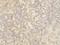 Cullin 4B antibody, LS-C172036, Lifespan Biosciences, Immunohistochemistry paraffin image 