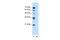 Ubiquitin Specific Peptidase 48 antibody, PA5-42644, Invitrogen Antibodies, Western Blot image 