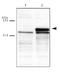 DNA Methyltransferase 3 Alpha antibody, GTX30365, GeneTex, Western Blot image 