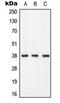 Linker For Activation Of T Cells antibody, MBS821952, MyBioSource, Western Blot image 