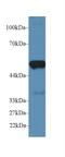 Prostaglandin E Synthase 2 antibody, LS-C296066, Lifespan Biosciences, Western Blot image 