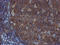 TUB Like Protein 3 antibody, M09384, Boster Biological Technology, Immunohistochemistry paraffin image 