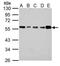 Inositol Hexakisphosphate Kinase 1 antibody, NBP2-43667, Novus Biologicals, Western Blot image 