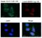 Aladin WD Repeat Nucleoporin antibody, 15127-1-AP, Proteintech Group, Immunofluorescence image 