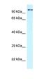 Cyclin Dependent Kinase 11A antibody, orb331151, Biorbyt, Western Blot image 