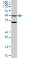 Serine/Threonine Kinase 40 antibody, H00083931-M04, Novus Biologicals, Western Blot image 
