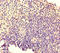 T Cell Lymphoma Invasion And Metastasis 1 antibody, orb44929, Biorbyt, Immunohistochemistry paraffin image 