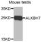 Probable alpha-ketoglutarate-dependent dioxygenase ABH7 antibody, abx001893, Abbexa, Western Blot image 