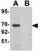 Leucine Rich Repeat Transmembrane Neuronal 1 antibody, GTX31823, GeneTex, Western Blot image 