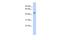 Ectonucleotide Pyrophosphatase/Phosphodiesterase 6 antibody, A11099, Boster Biological Technology, Western Blot image 