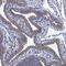 Transmembrane O-methyltransferase antibody, NBP1-92081, Novus Biologicals, Immunohistochemistry paraffin image 