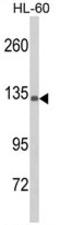 Complement C5 antibody, AP17914PU-N, Origene, Western Blot image 