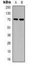 Transforming Growth Factor Beta Receptor 2 antibody, LS-C368750, Lifespan Biosciences, Western Blot image 