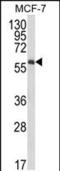 Interleukin 10 Receptor Subunit Alpha antibody, PA5-35361, Invitrogen Antibodies, Western Blot image 