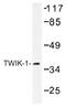 Potassium Two Pore Domain Channel Subfamily K Member 1 antibody, AP01494PU-N, Origene, Western Blot image 