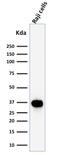 POU Class 2 Homeobox Associating Factor 1 antibody, GTX17983, GeneTex, Western Blot image 