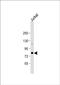 AlkB Homolog 8, TRNA Methyltransferase antibody, PA5-49590, Invitrogen Antibodies, Western Blot image 