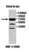 Zinc Finger Protein 264 antibody, orb78065, Biorbyt, Western Blot image 