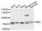 Dopamine Beta-Hydroxylase antibody, LS-C332224, Lifespan Biosciences, Western Blot image 