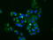 Mitogen-Activated Protein Kinase 11 antibody, GTX84149, GeneTex, Immunocytochemistry image 