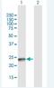 SSX Family Member 4B antibody, H00548313-B01P-50ug, Novus Biologicals, Western Blot image 