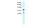 Asialoglycoprotein Receptor 2 antibody, GTX47749, GeneTex, Western Blot image 