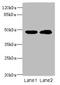 Heterogeneous Nuclear Ribonucleoprotein H1 antibody, A56615-100, Epigentek, Western Blot image 