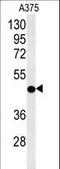 Citrate Synthase antibody, LS-C167073, Lifespan Biosciences, Western Blot image 