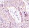 Eukaryotic Translation Initiation Factor 4 Gamma 1 antibody, MA5-14971, Invitrogen Antibodies, Immunohistochemistry paraffin image 